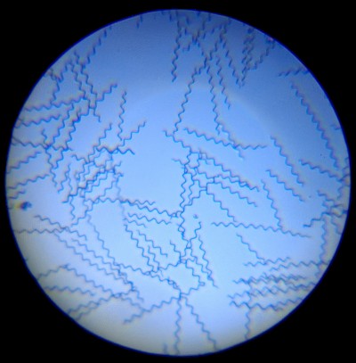 spirulina microscopic image 1 - no background - 2